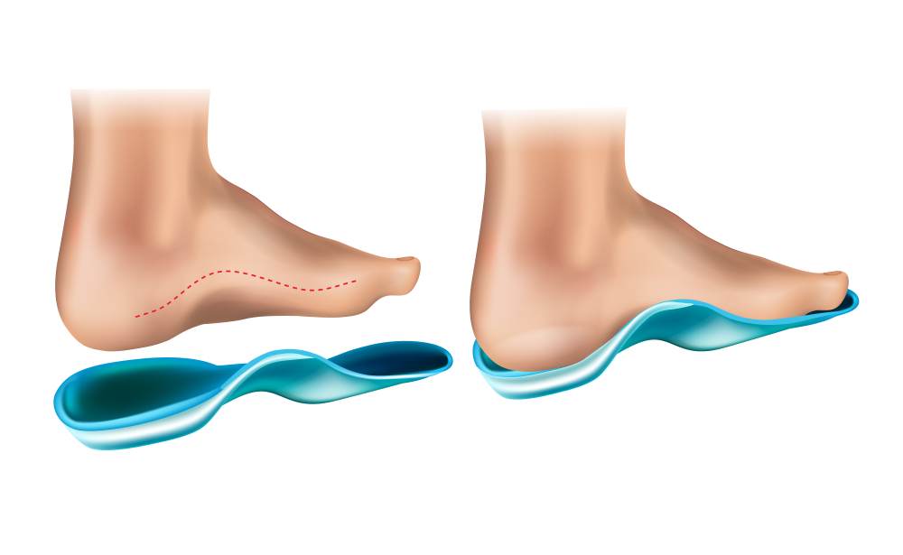 best orthotics shoes for foot issues