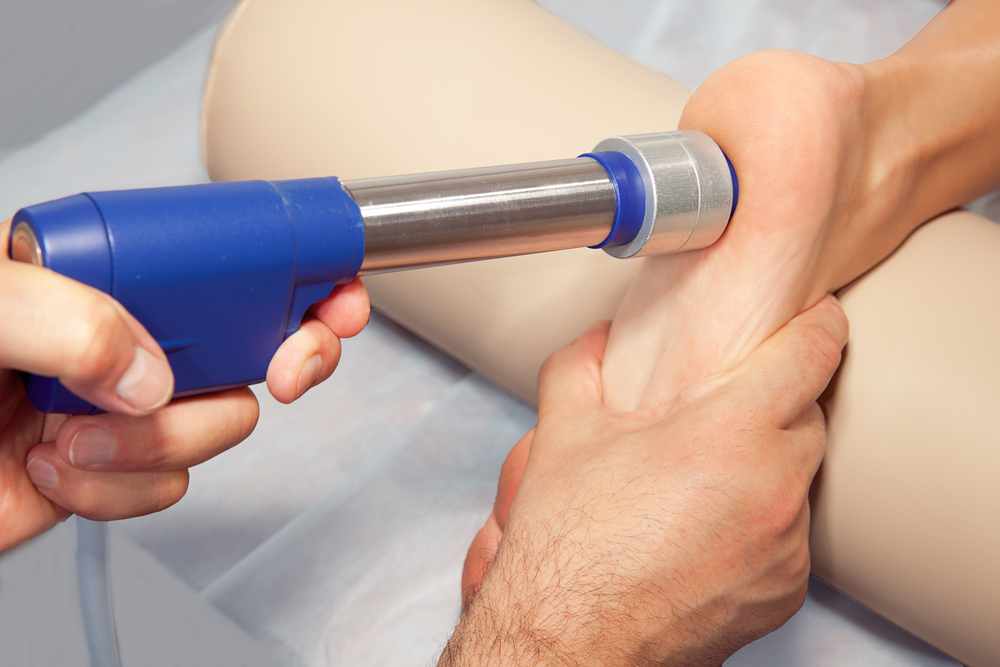 shock-wave-therapy-plantar-fasciitis